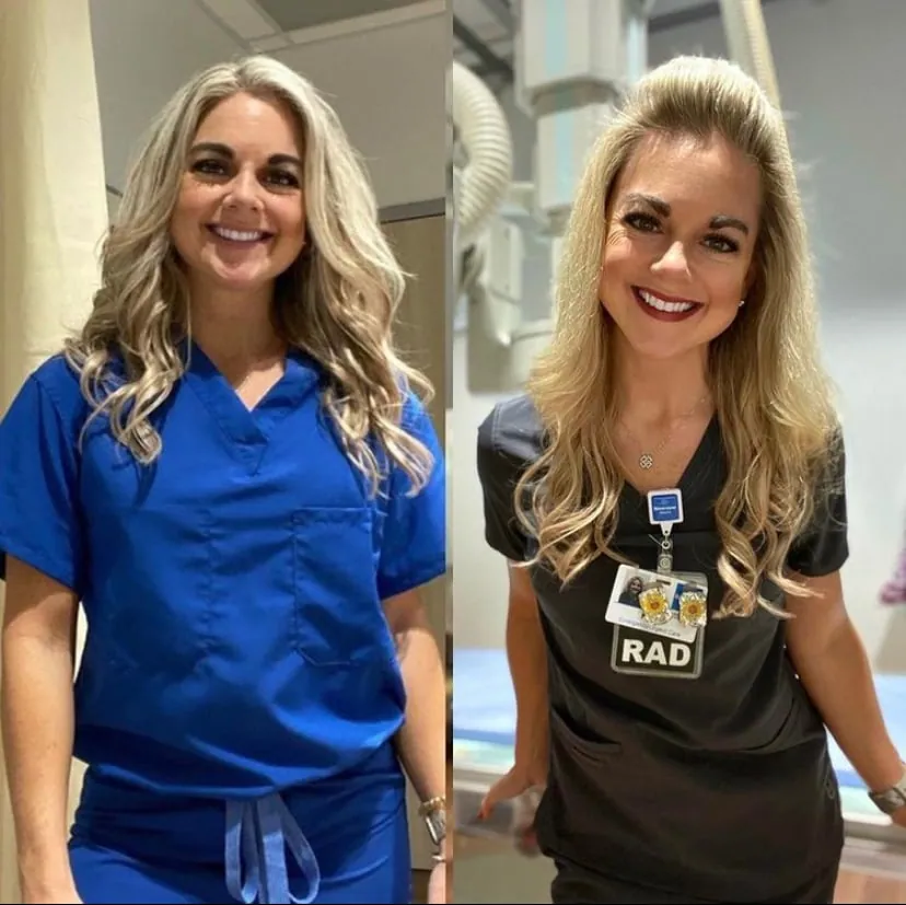 Carnivore Diet Female Before After