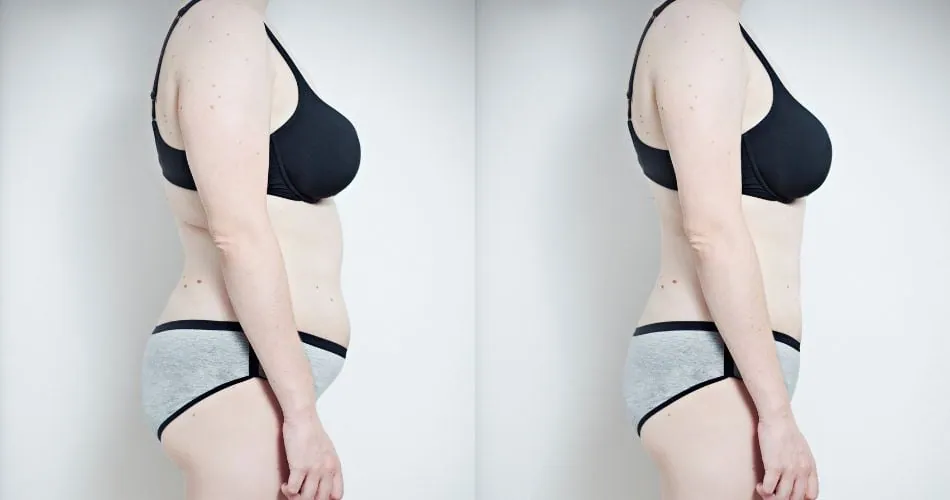 Women Before and After Results